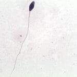 Tapered Sperm
