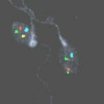 Sperm Chromosome Aneuploidy