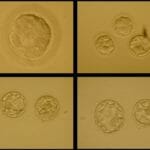 Morula to Blastocyst Embryogenesis